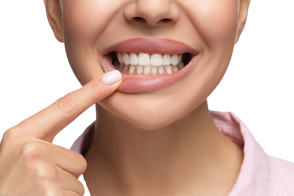 Dental Bonding And Teeth Whitening