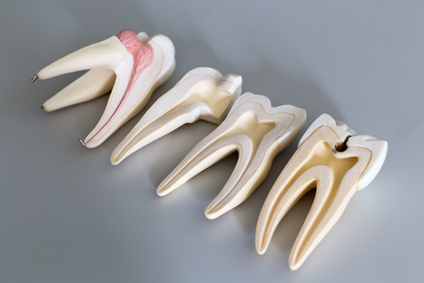 The Root Canal Procedure Explained: Step By Step