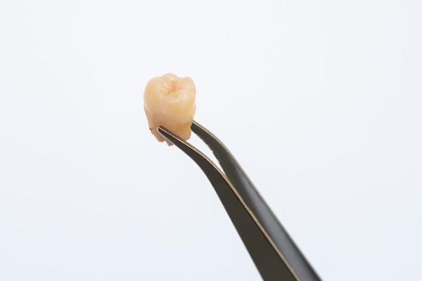 When Is Wisdom Tooth Extraction Recommended?